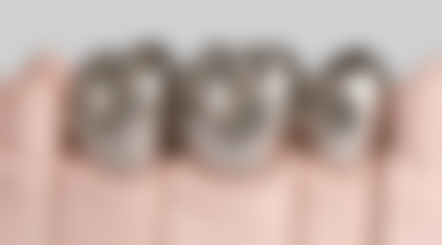 深圳新安麦芽口腔拔牙后多久能种牙靠谱吗？