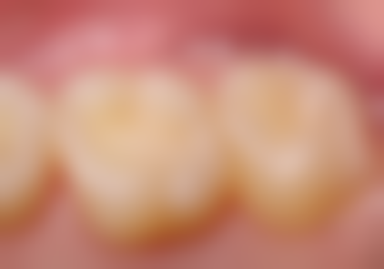 诸城王志文口腔诊所预约挂号方式