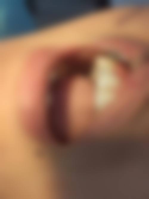 永州宁远牙总管口腔真实实例