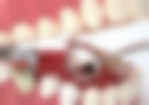 郎雨萍医生怎么预约挂号