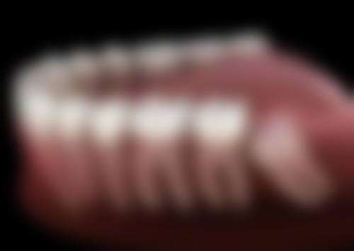 五岁小孩拔牙后如何护理