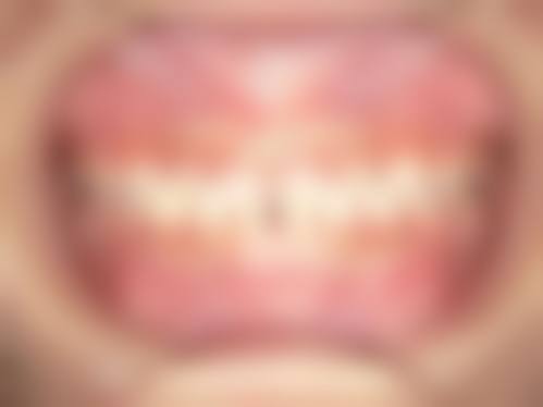 深圳市宝安区中 心医院口腔医学科地址及乘车路线