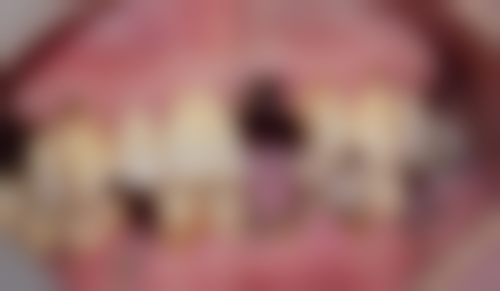 安阳林州郭增义口腔门诊部擅长项目