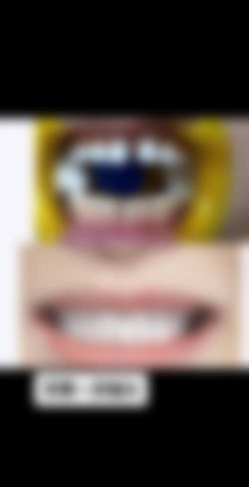 广东深圳明珠口腔擅长项目