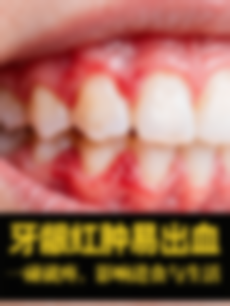 关增辉医生擅长项目：精细解决各类正畸难题