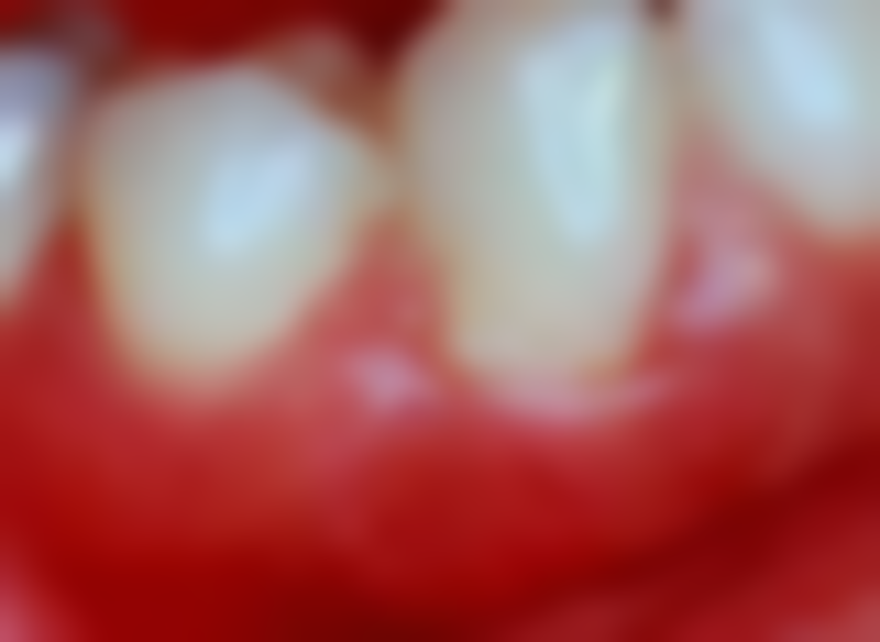 吴雪琪医生坐诊医院:嘉兴嘉诚口腔,优质医疗保护