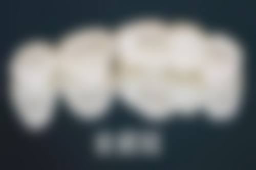 九价和拔牙可以一起吗？权威解答：为健康着想，两者不宜同时进行，分开操作更稳妥！ 