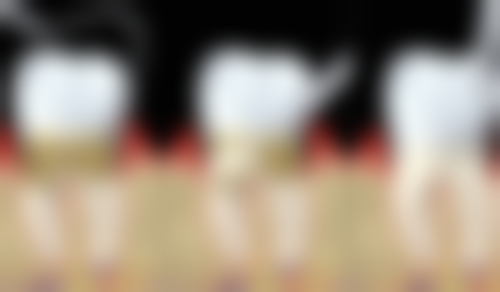 通州区刘婧医生补牙靠不靠谱