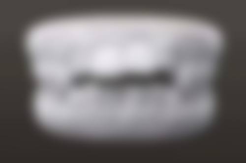 陕西渭南白水佳益明军口腔口碑怎么样：患者好评满满