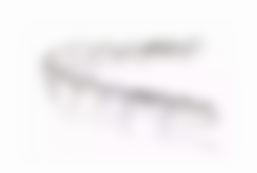 如何在换牙期间矫正地包天