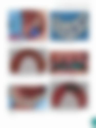 陕西渭南白水佳益明军口腔真实实例：见证神奇改变