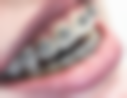 谷丹医生技术特点：精细效率高，创新领跑