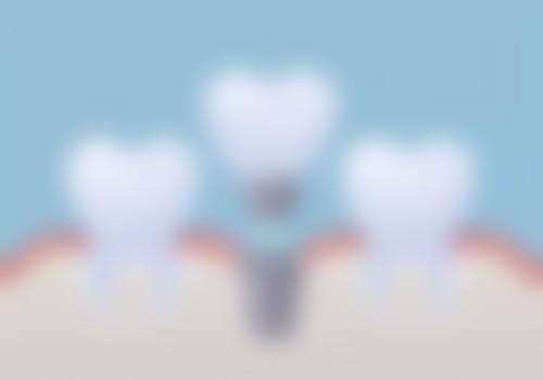 达美门诊绿地口腔诊所真实实例