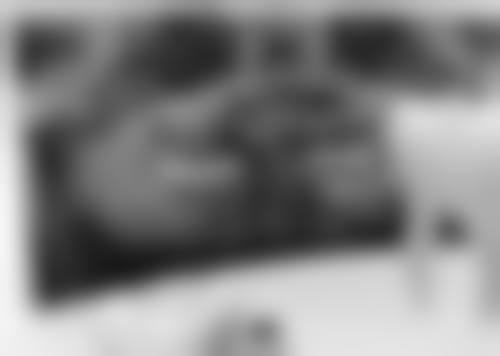 做完根管治疗一个月戴牙冠适合吗