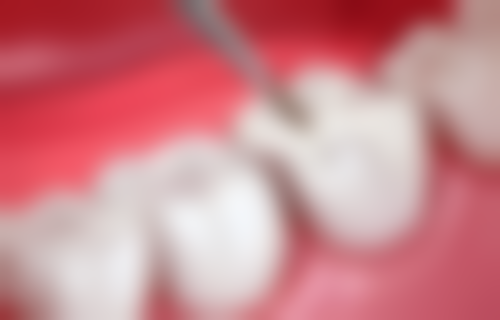 温州市龙湾海滨雅乐口腔门诊部真实实例