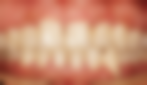 儿童使用洗牙器要注意什么