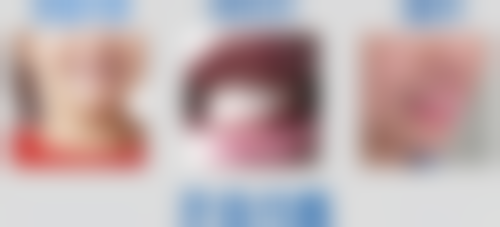 洗牙补牙挂什么科室？口腔医院挂牙周科和牙体牙髓科，综合医院挂口腔科，一文为你讲清！ 