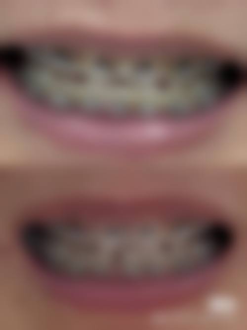 广东东莞友冠口腔门诊部价格表