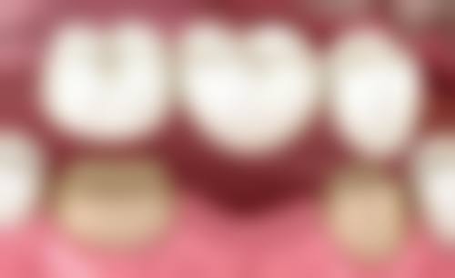 百川口腔门诊部口碑怎么样