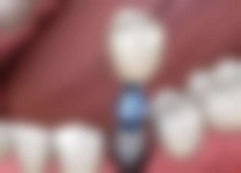 咸阳诺贝尔口腔医院营业时间