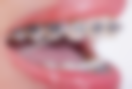 雅安雨城美雅口腔诊所地址及乘车路线