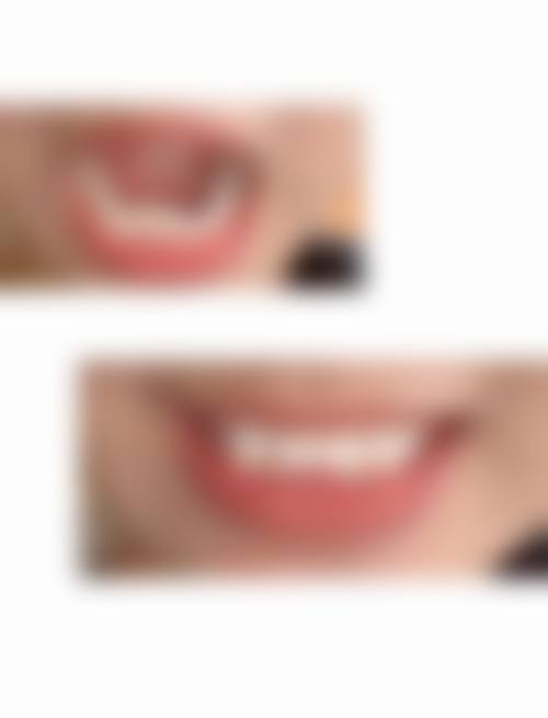 深圳平头牙匠口腔医院口碑怎么样