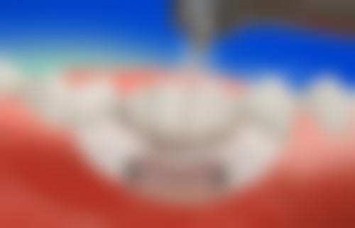 不确定补牙拔牙挂什么科怎么办