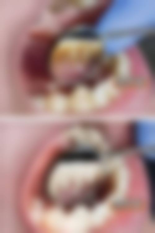 深圳陈闯口腔诊所价格表