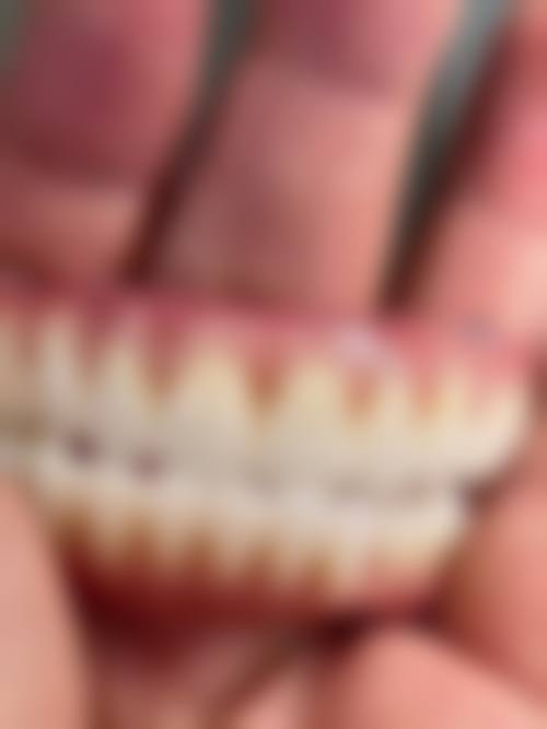 苏州姑苏花永明口腔诊所真实实例