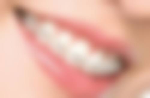 全瓷牙牙的寿命受患者牙齿本身情况影响大吗