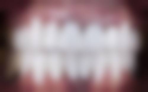 广东中山思维口腔口碑怎么样：患者的真实评价