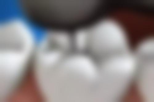 建水象贝口腔门诊部价格表:透明消费,物超所值