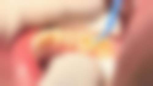 广东江门台山黄项初口腔诊所擅长项目