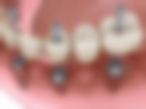 渭南晶诚口腔预约挂号方式