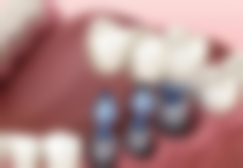 南宁品位口腔诊所价格表