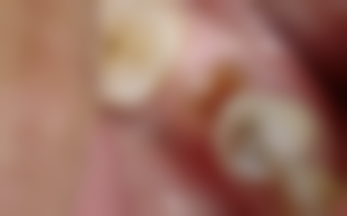 苏州舒美口腔门诊部收费贵不贵？是否正规透明？