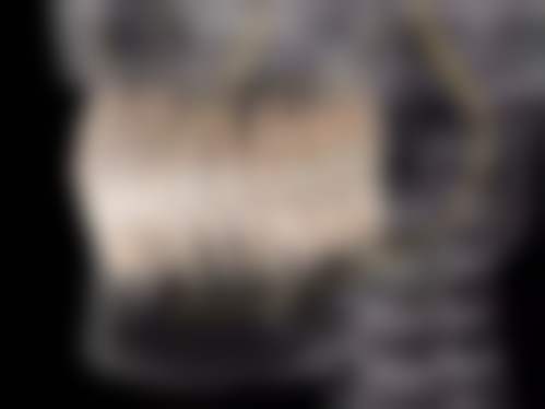 呼和浩特至美口腔门诊部（凯元广场店）真实实例