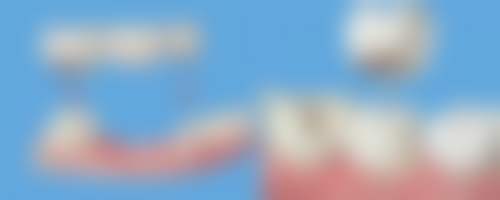 沧州市新华区瑞恒口腔诊所预约挂号方式