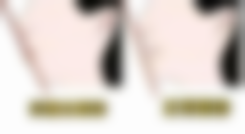 牙齿有点发黄洗牙后成效怎么样