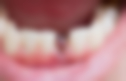 杭州西湖卢朝阳口腔诊所口碑怎么样