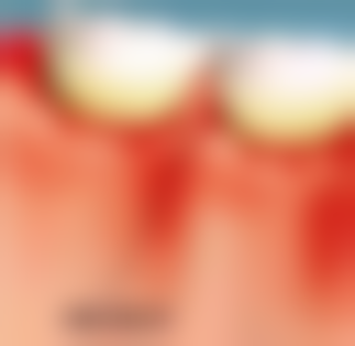 杨笑草医生看诊优势