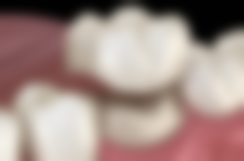 张运发医生看诊优势