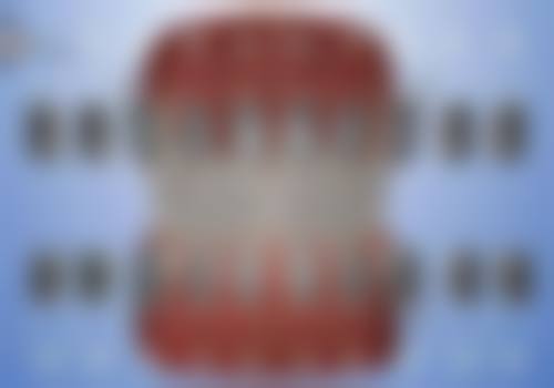 雅宣口腔门诊部价格表