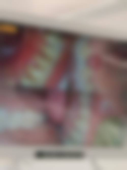 海口赛果阳光连锁齿科(友谊店)价格表