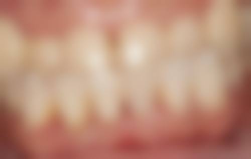 山东潍坊寿光苏春江口腔真实实例