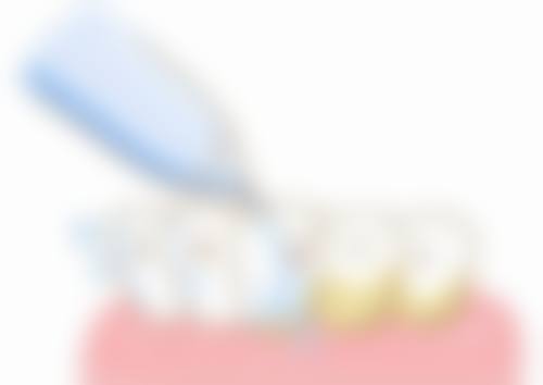 中山大学附属口腔医院口腔种植科仪器设备