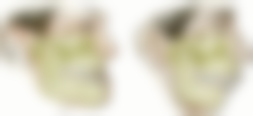 北京市许俊豪主攻项目的治疗成效值不值