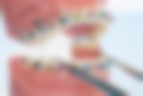 补牙可以使用医保吗？揭秘口腔医保政策，补牙哪些项目可报销，让你明明白白看牙！ 