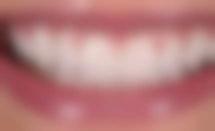 东莞长安爱齐口腔执业信息：正规可靠有保护