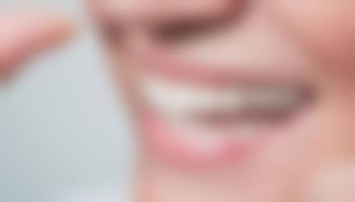 耒阳诺贝尔口腔真实实例